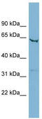Solute Carrier Family 25 Member 21 antibody, TA333648, Origene, Western Blot image 