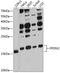 Prefoldin Subunit 2 antibody, A11752, Boster Biological Technology, Western Blot image 