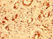 Epithelial Splicing Regulatory Protein 2 antibody, CSB-PA007833LA01HU, Cusabio, Immunohistochemistry paraffin image 
