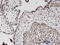 RIO Kinase 2 antibody, LS-C134085, Lifespan Biosciences, Immunohistochemistry paraffin image 