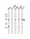 LAG1 longevity assurance homolog 4 antibody, M30561, Boster Biological Technology, Western Blot image 