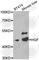 Hepatocyte Growth Factor antibody, A1193, ABclonal Technology, Western Blot image 