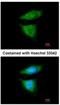 Cytoplasmic dynein 1 intermediate chain 2 antibody, NBP1-31703, Novus Biologicals, Immunocytochemistry image 