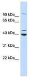 C-Terminal Binding Protein 1 antibody, TA330557, Origene, Western Blot image 