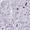 Delta Like Non-Canonical Notch Ligand 2 antibody, HPA061223, Atlas Antibodies, Immunohistochemistry paraffin image 