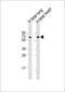 ALG6 Alpha-1,3-Glucosyltransferase antibody, 61-313, ProSci, Western Blot image 