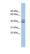 F-Box And Leucine Rich Repeat Protein 14 antibody, NBP1-79520, Novus Biologicals, Western Blot image 