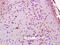 Junction Mediating And Regulatory Protein, P53 Cofactor antibody, GTX51804, GeneTex, Immunohistochemistry paraffin image 