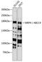 ATP Binding Cassette Subfamily C Member 4 antibody, GTX30016, GeneTex, Western Blot image 