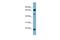 Zinc Finger Protein 746 antibody, PA5-40498, Invitrogen Antibodies, Western Blot image 