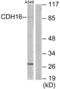 Cadherin-16 antibody, LS-C119408, Lifespan Biosciences, Western Blot image 