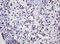 Decapping Enzyme, Scavenger antibody, M02684, Boster Biological Technology, Immunohistochemistry paraffin image 