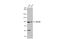 Zinc Finger Protein 598 antibody, GTX119245, GeneTex, Western Blot image 