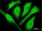 Cytoglobin antibody, H00114757-M02, Novus Biologicals, Immunofluorescence image 