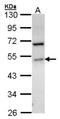 Sphingosine Kinase 1 antibody, NBP2-20472, Novus Biologicals, Western Blot image 