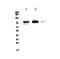 SATB Homeobox 1 antibody, A01312-1, Boster Biological Technology, Western Blot image 