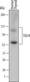 Thyroid Stimulating Hormone Receptor antibody, MAB6534, R&D Systems, Western Blot image 