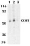 C-C Motif Chemokine Receptor 3 antibody, AHP1010, Bio-Rad (formerly AbD Serotec) , Immunohistochemistry paraffin image 