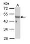 Keratin 33B antibody, LS-C186272, Lifespan Biosciences, Western Blot image 