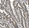 Sorbin And SH3 Domain Containing 1 antibody, A04426-3, Boster Biological Technology, Immunohistochemistry frozen image 