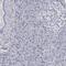 Granzyme H antibody, HPA029200, Atlas Antibodies, Immunohistochemistry paraffin image 