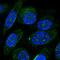 Zinc Finger Protein 586 antibody, HPA030306, Atlas Antibodies, Immunofluorescence image 