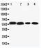 Cytochrome P450 Family 1 Subfamily A Member 2 antibody, PA1907, Boster Biological Technology, Western Blot image 