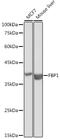 Fructose-Bisphosphatase 1 antibody, GTX54007, GeneTex, Western Blot image 