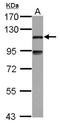 Microtubule Associated Protein 7 antibody, NBP2-17222, Novus Biologicals, Western Blot image 
