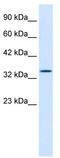 Hematopoietically-expressed homeobox protein HHEX antibody, TA329287, Origene, Western Blot image 