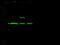 E3 ubiquitin-protein ligase CHIP antibody, GTX02364, GeneTex, Western Blot image 