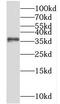 Homeobox protein Nkx-3.1 antibody, FNab05752, FineTest, Western Blot image 