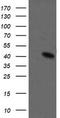 Mitogen-Activated Protein Kinase Kinase 1 antibody, TA505704BM, Origene, Western Blot image 