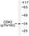 Cyclin Dependent Kinase 2 antibody, AP01550PU-N, Origene, Western Blot image 