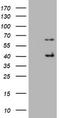 Basic Cytokeratin antibody, CF801092, Origene, Western Blot image 