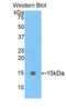 Fatty Acid Binding Protein 5 antibody, LS-C297842, Lifespan Biosciences, Western Blot image 