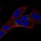 Neuronal Vesicle Trafficking Associated 2 antibody, HPA046531, Atlas Antibodies, Immunocytochemistry image 