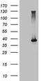 Natural Cytotoxicity Triggering Receptor 2 antibody, TA809536, Origene, Western Blot image 