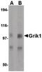 Glutamate Ionotropic Receptor Kainate Type Subunit 1 antibody, PA5-20448, Invitrogen Antibodies, Western Blot image 