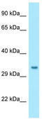 Protein NipSnap homolog 1 antibody, TA338226, Origene, Western Blot image 