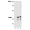 Superoxide Dismutase 2 antibody, MBS565332, MyBioSource, Western Blot image 