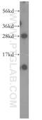 Nipsnap Homolog 3B antibody, 11789-1-AP, Proteintech Group, Western Blot image 