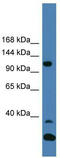 Tyrosine Kinase 2 antibody, TA329144, Origene, Western Blot image 