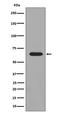P21 (RAC1) Activated Kinase 3 antibody, P03124, Boster Biological Technology, Western Blot image 
