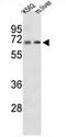 Peroxisomal carnitine O-octanoyltransferase antibody, AP51088PU-N, Origene, Western Blot image 