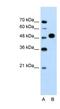 Makorin Ring Finger Protein 1 antibody, NBP1-55226, Novus Biologicals, Western Blot image 