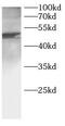 FIP-3 antibody, FNab10324, FineTest, Western Blot image 