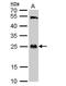 Glutathione S-transferase theta-1 antibody, NBP1-32733, Novus Biologicals, Western Blot image 