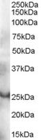 GRB2 Related Adaptor Protein antibody, orb18308, Biorbyt, Western Blot image 