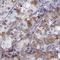 Gonadotropin Releasing Hormone Receptor antibody, HPA013424, Atlas Antibodies, Immunohistochemistry paraffin image 